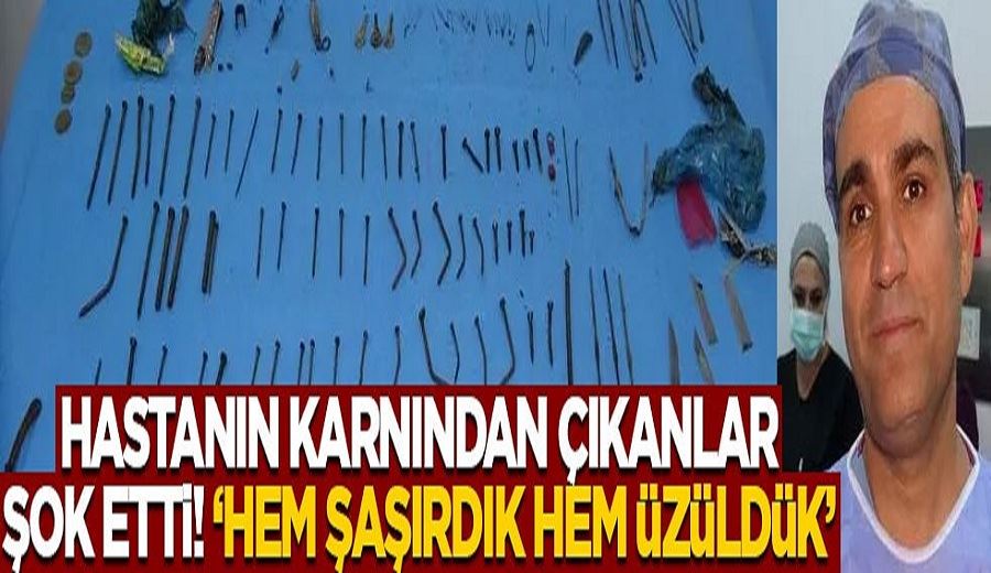 Vanlı kadının midesinden 158 parça metal çıktı