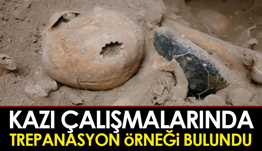 Kazı çalışmalarında trepanasyon örneği bulundu