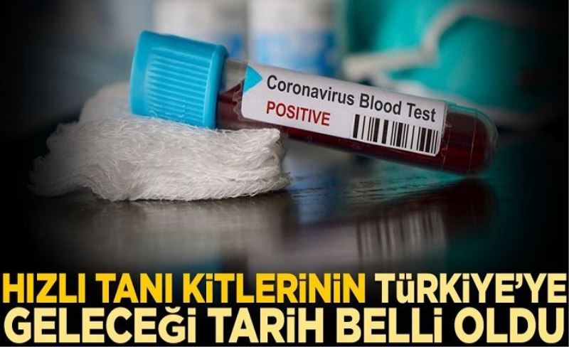 Koronavirüs hızlı tanı kitlerinin Türkiye’ye geleceği tarih belli oldu