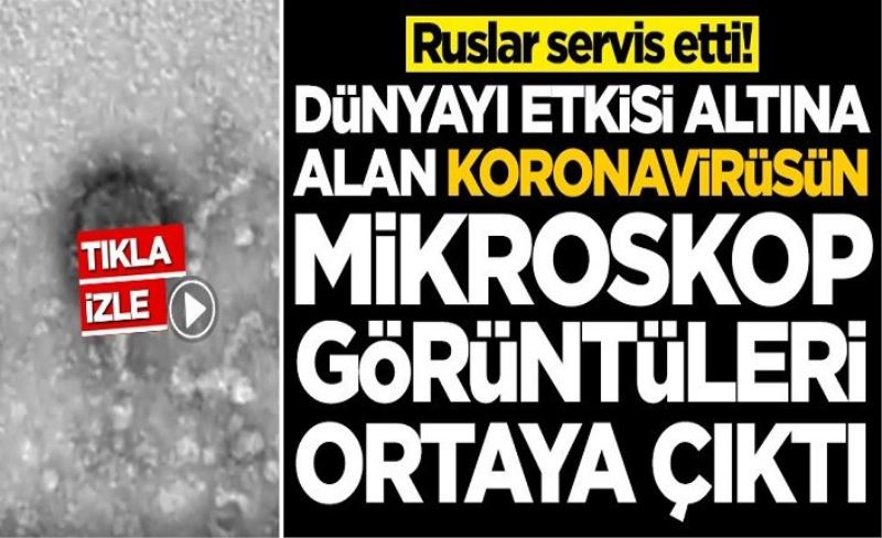 Ruslar servis etti! Dünyayı etkisi altına alan koronavirüsün mikroskop görüntüleri ortaya çıktı