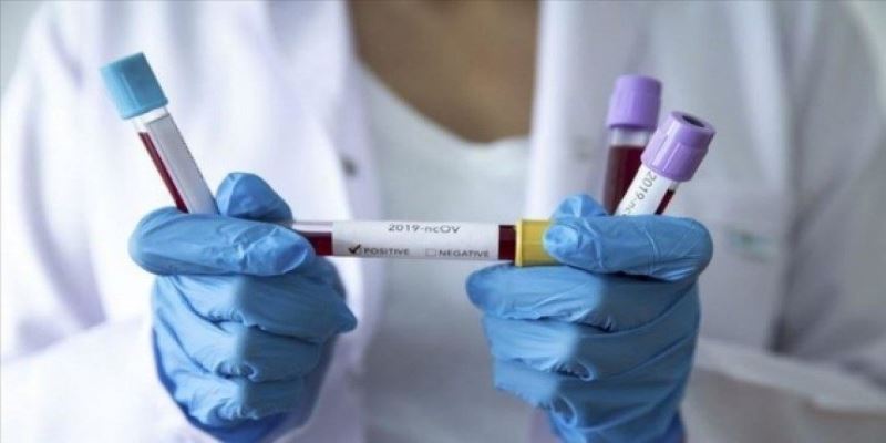 Dünyayı heyecanlandıran açıklama: Koronavirüsü 2 günde öldüren ilaç bulundu