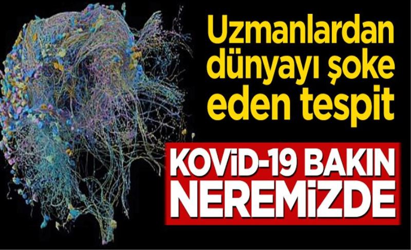 Uzmanlardan dünyayı şoke eden tespit! Kovid-19 beyinde