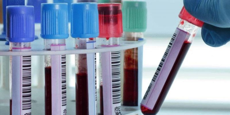 Koronavirüse en az yakalanan kan grubu açıklandı