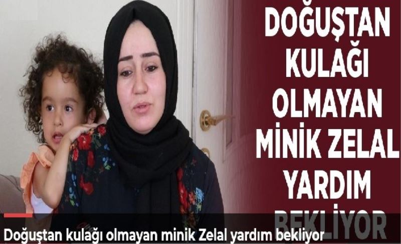 Doğuştan kulağı olmayan minik Zelal yardım bekliyor