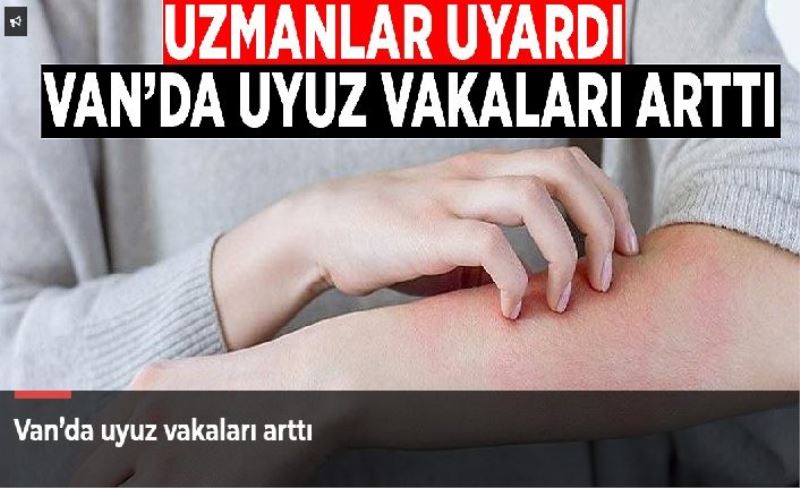 Van’da uyuz vakaları arttı