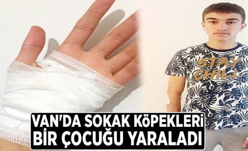 Van'da sokak köpekleri bir çocuğu yaraladı