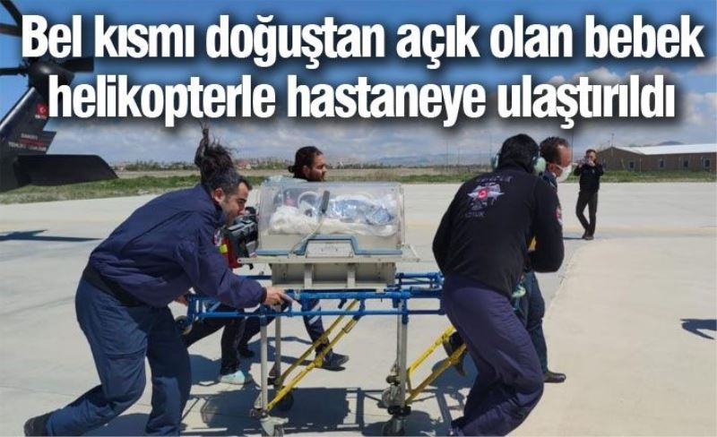 Bel kısmı doğuştan açık olan bebek helikopterle hastaneye ulaştırıldı